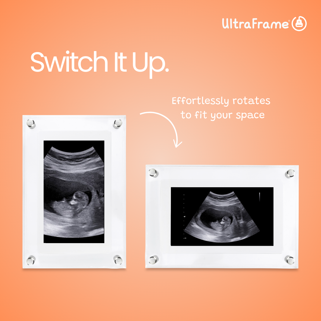 UltraFrame™ – Digital Frame