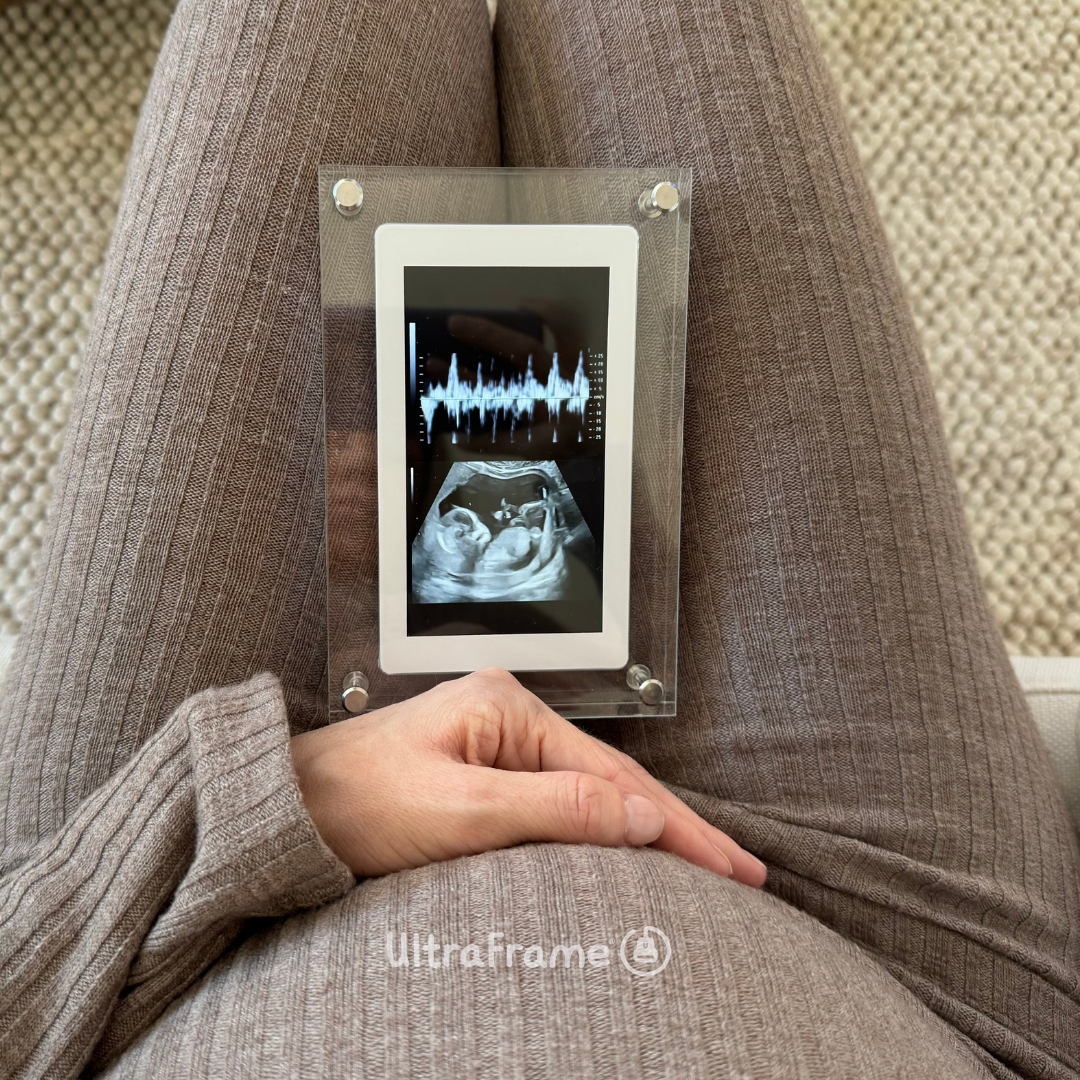 UltraFrame™ – Digital Frame